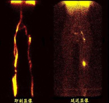 下肢深靜脈2.jpg